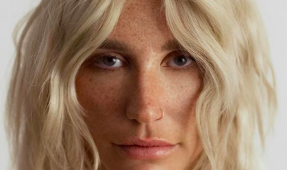 Kesha revela que “quase morreu” após realizar congelamento de óvulos