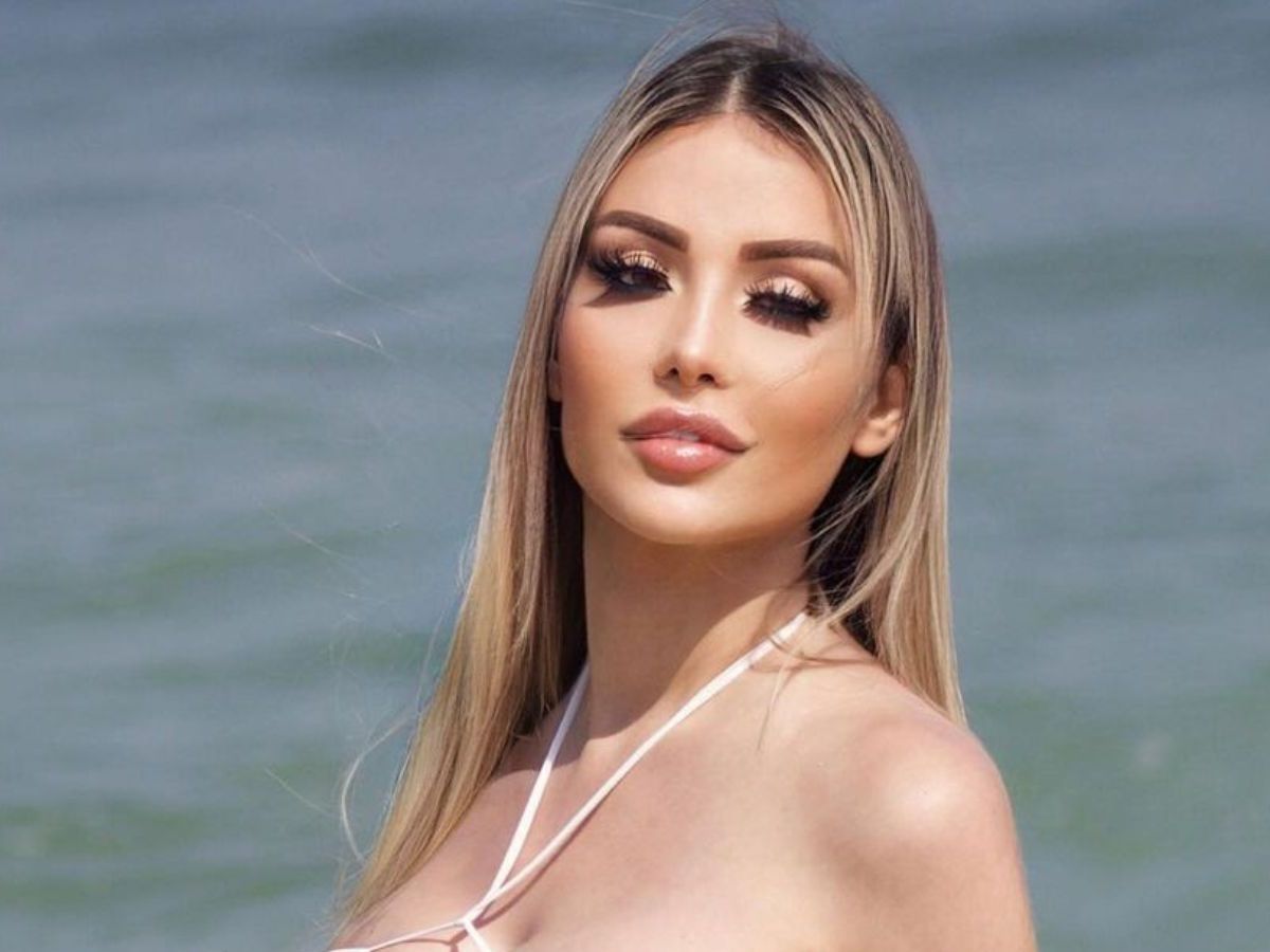 Modelo Lygia Fazio morre após complicações em procedimento estético; entenda riscos | CNN Brasil