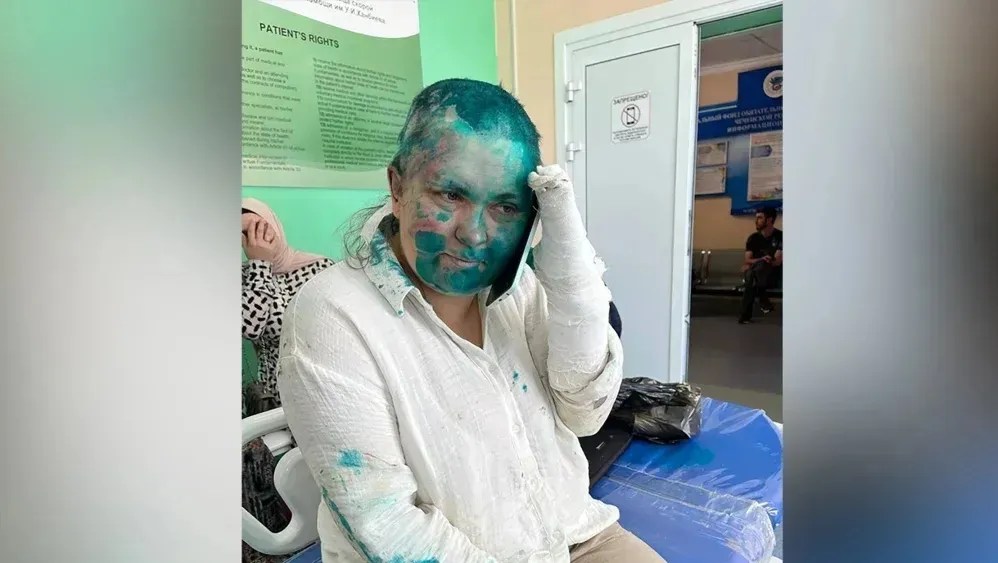 Jornalista russa Elena Milashina foi atacada e mergulhada em uma substância verde