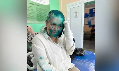 Jornalista russa é espancada na Chechênia e atingida com substância verde no rosto