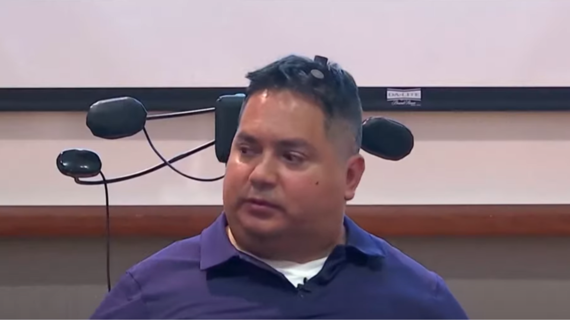 Keith Thomas recuperou os movimentos do corpo após implantar chips com algorítimos de inteligência artificial no cérebro