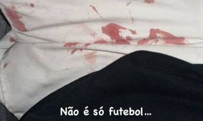 Luan posta foto com marcas de sangue na roupa após ser agredido por torcedores