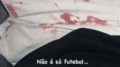 Luan posta foto com marcas de sangue na roupa após ser agredido por torcedores