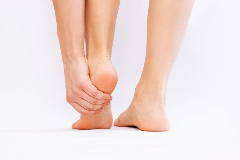Sintomas da fascite plantar / Imagem: Shutterstock