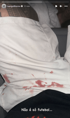 Luan publicou foto com calção machando de sangue. / Reprodução / Instagram