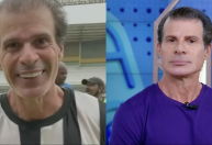 Túlio Maravilha revela resultado de harmonização facial; veja como ficou