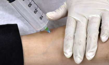 Processos não comprovaram eficácia médica da ozonioterapia, diz à CNN gerente da Anvisa