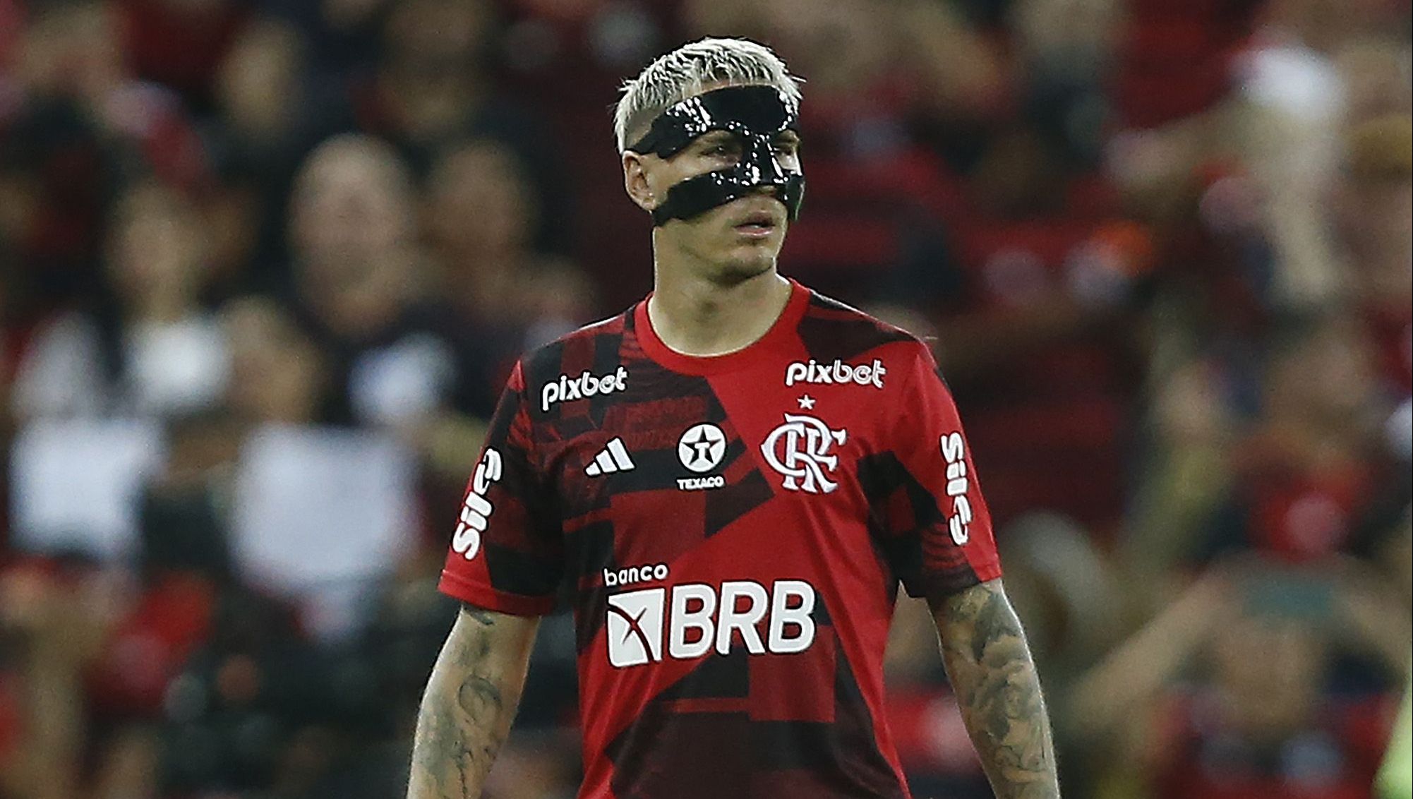 Titular, Varela vai usar máscara de proteção após ter o nariz fraturado por soco de Gerson