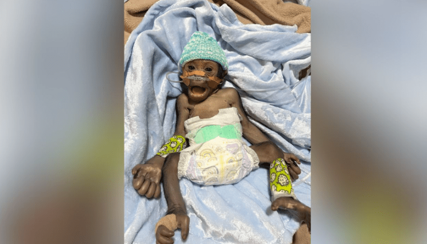 Kaius foi diagnosticado com pneumonia depois que seus pais não cuidaram dele / Chad Staples/Mogo Wildlife Park