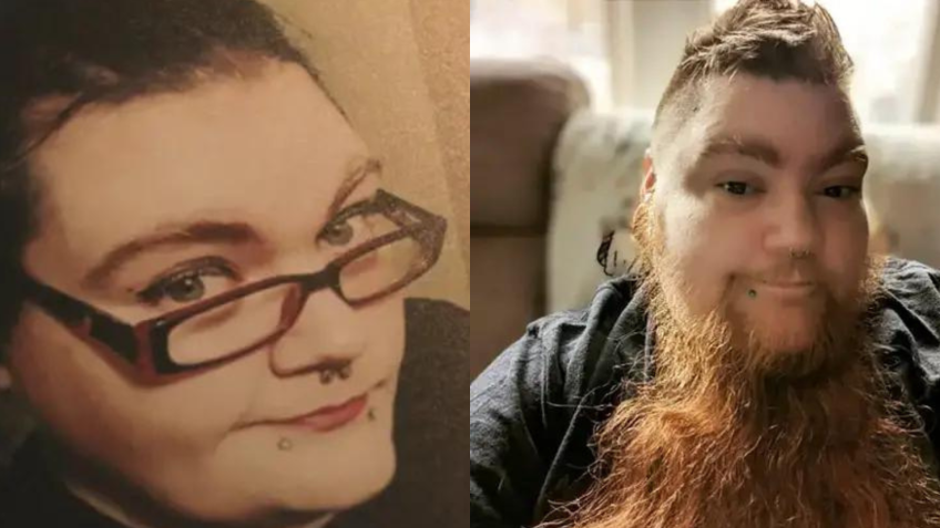 Uma foto de Erin mais jovem ao lado dela atualmente, com sua barba de 30 centímetros / Guinness World Records