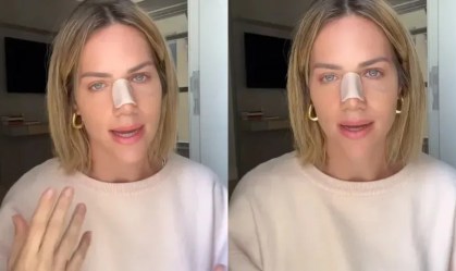 Imagem de destaque do post: Afastada das redes sociais, Giovanna Ewbank revela cirurgia: "Estou muito bem"