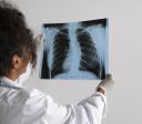 Envelhecimento afeta função dos pulmões; saiba como testar "idade" pulmonar