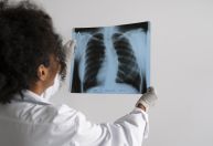 Bronquiolite é a principal causa de morte de crianças de até 1 ano, alerta infectologista