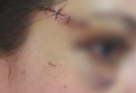 Policial atingida por disparos de Roberto Jefferson pede R$ 1 milhão de indenização