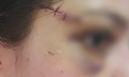 Policial atingida por disparos de Roberto Jefferson pede R$ 1 milhão de indenização