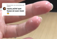 Jovem viraliza com suor excessivo nas mãos; médico explica o que fazer na onda de calor