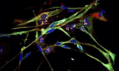 Cientistas transformam células cancerígenas em unidades musculares saudáveis
