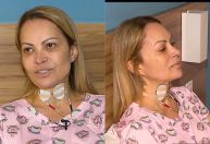 Simone Almeida desabafa sobre consequências após uso de cigarro eletrônico