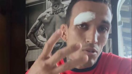 Charles do Bronx falou sobre a lesão no Instagram