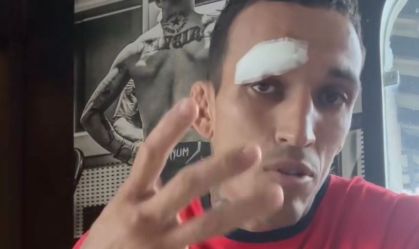 Imagem forte: Charles do Bronx tem lesão chocante, e luta no UFC é cancelada