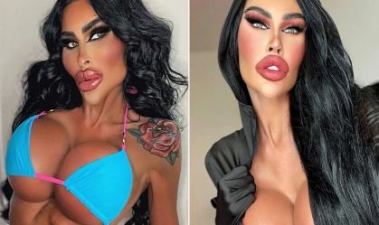 'Barbie humana' que gastou mais de R$1 mi volta atrás e desfaz procedimentos