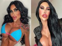 'Barbie humana' que gastou mais de R$1 mi volta atrás e desfaz procedimentos