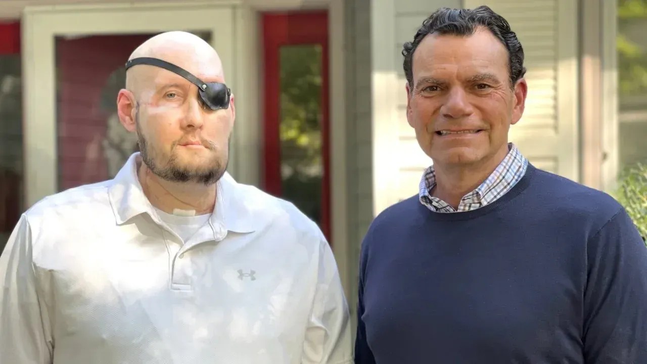 231108201309-03-whole-eye-partial-face-transplant