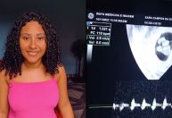 Jovem de 18 anos descobre gravidez de quíntuplos e passa mal; veja vídeo