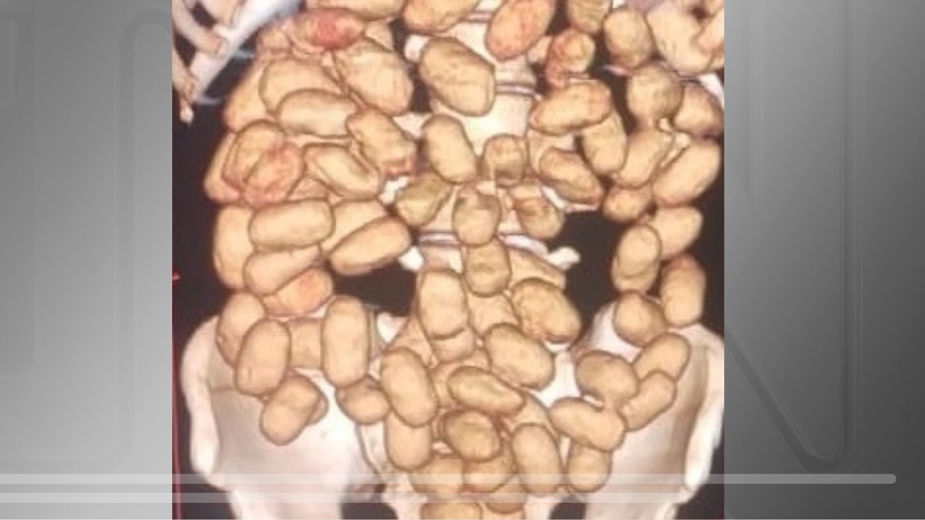 Drogas