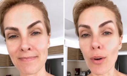 Imagem do vídeo postado por Ana Hickmann nas redes sociais após denúncia de agressão