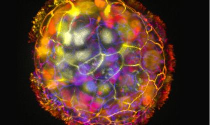 Cientistas constroem robôs com função curativa usando células humanas