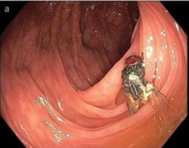 mosca-intestino-alimentação