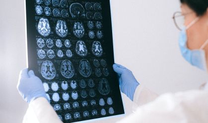 Novo teste pode detectar câncer cerebral em até 1 hora, diz estudo