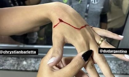 Nenê, do Juventude, paga fiança após quebrar vidro em jogo contra o Ceará