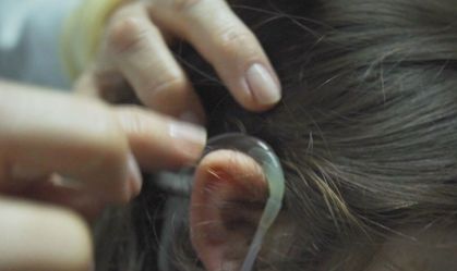 Implante coclear, aparelho auditivo e estapedectomia são tema do CNN Sinais Vitais