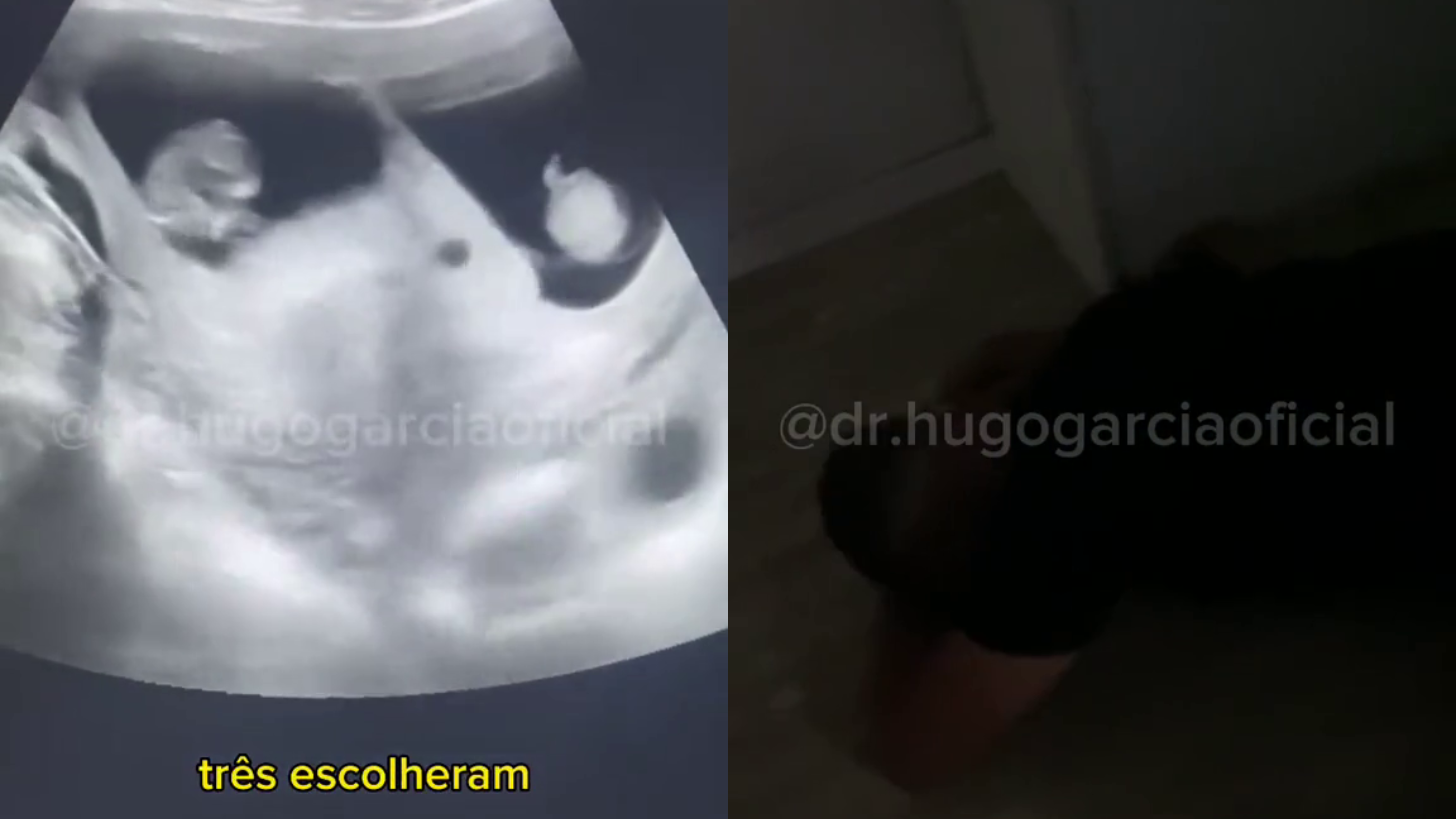 Pai desmaia ultrassom de trigemeos