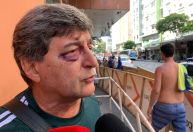 “Não são gente”, diz homem nocauteado por bandidos em Copacabana