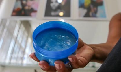 Anvisa cancela 1,2 mil pomadas de cabelo após surto de queimaduras no Rio; veja quais estão liberadas