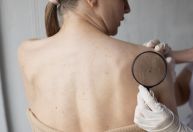 Dermatologistas fazem mutirão para diagnosticar câncer de pele neste sábado (7)