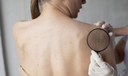 Dermatologistas fazem mutirão para diagnosticar câncer de pele neste sábado (7)