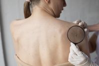 Dr. Kalil: Entenda como é realizado o tratamento de câncer de pele