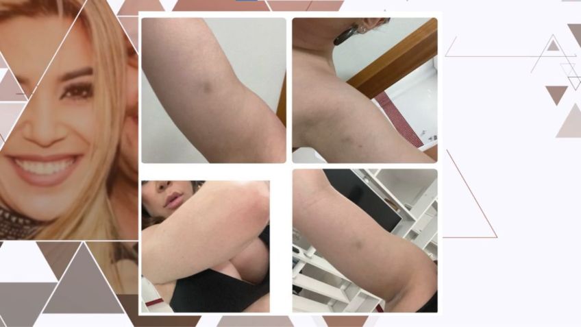 Fotos que foram anexadas no processo da cantora contra o ex-marido / Reprodução Globoplay
