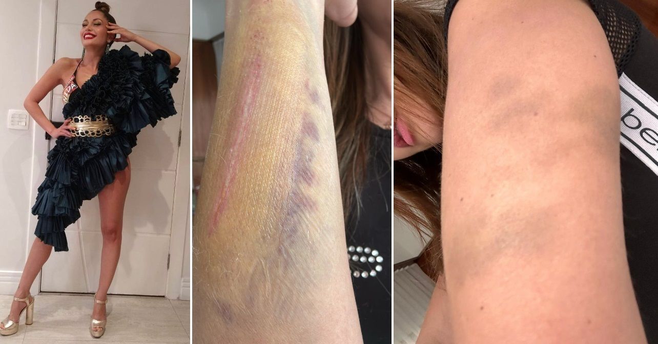 Imagem de destaque do post: Campeã do BBB11 alega agressão e pede medida protetiva contra humorista