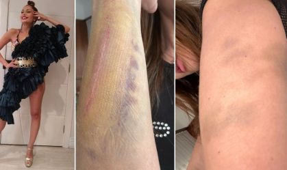 Imagem de destaque do post: Campeã do BBB11 alega agressão e pede medida protetiva contra humorista