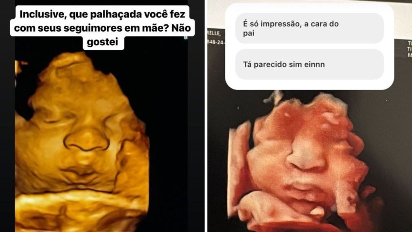 Ary Mirelle mostra rostinho do filho na ultrassonografia / Reprodução/Ary Mirelle/Instagram