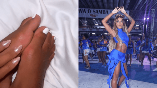Brunna Gonçalves, musa da Beija-Flor, saiu do ensaio de quinta-feira (18) com bolhas nos pés
