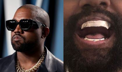 kanye west protese titanio