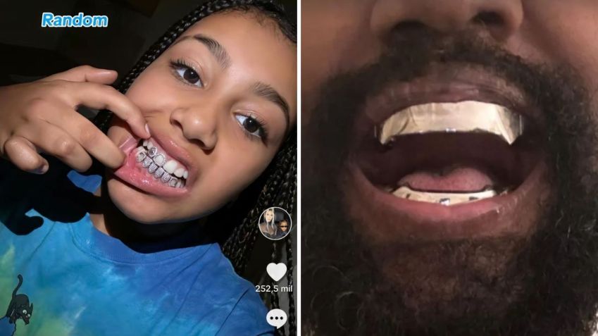 North e Kanye mostrando acessórios nos dentes / Reprodução/TikTok/Instagram