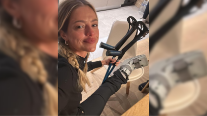Atriz Agatha Moreira com pé machucado durante viagem à França