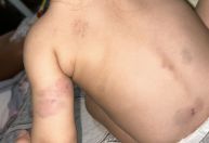 Bebê sofre agressões de outras crianças em creche no Rio; família alega omissão de socorro